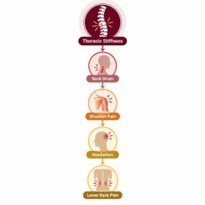 How thoracic spine stiffness contributes to neck, shoulder, headache, and lower back problems